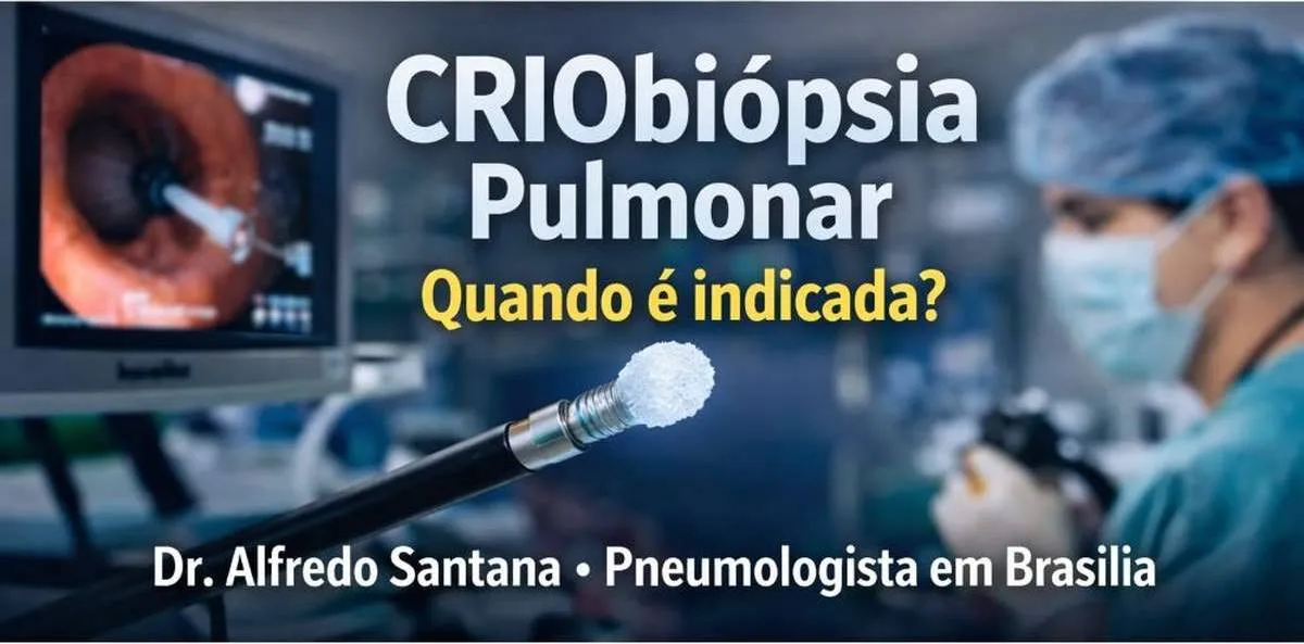 Criobiópsia pulmonar por broncoscopia: o que é, quando indicar e quais as vantagens