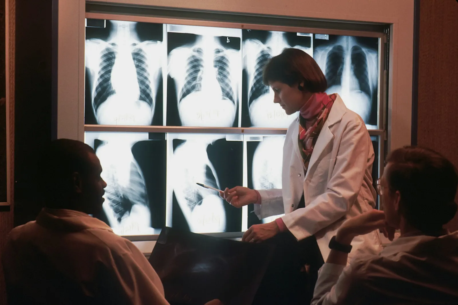 Pneumonia: médica analisando radiografias de tórax com a equipe