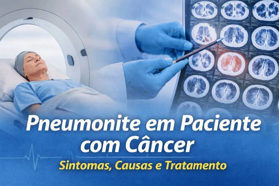 Pneumonite em Paciente com Câncer: Sintomas, Causas e Tratamento